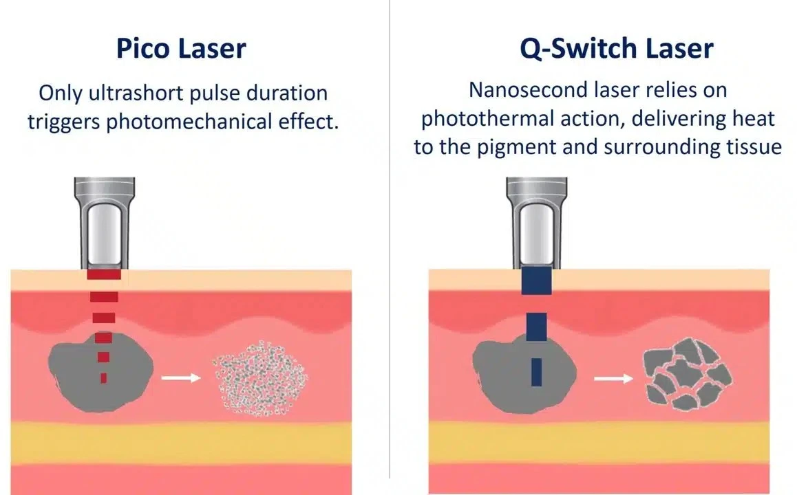 pico laser and q-switch laser pico laser and q-switch laser