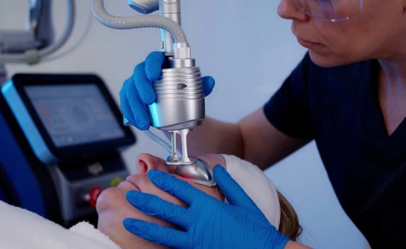 laser treatment laser treatment